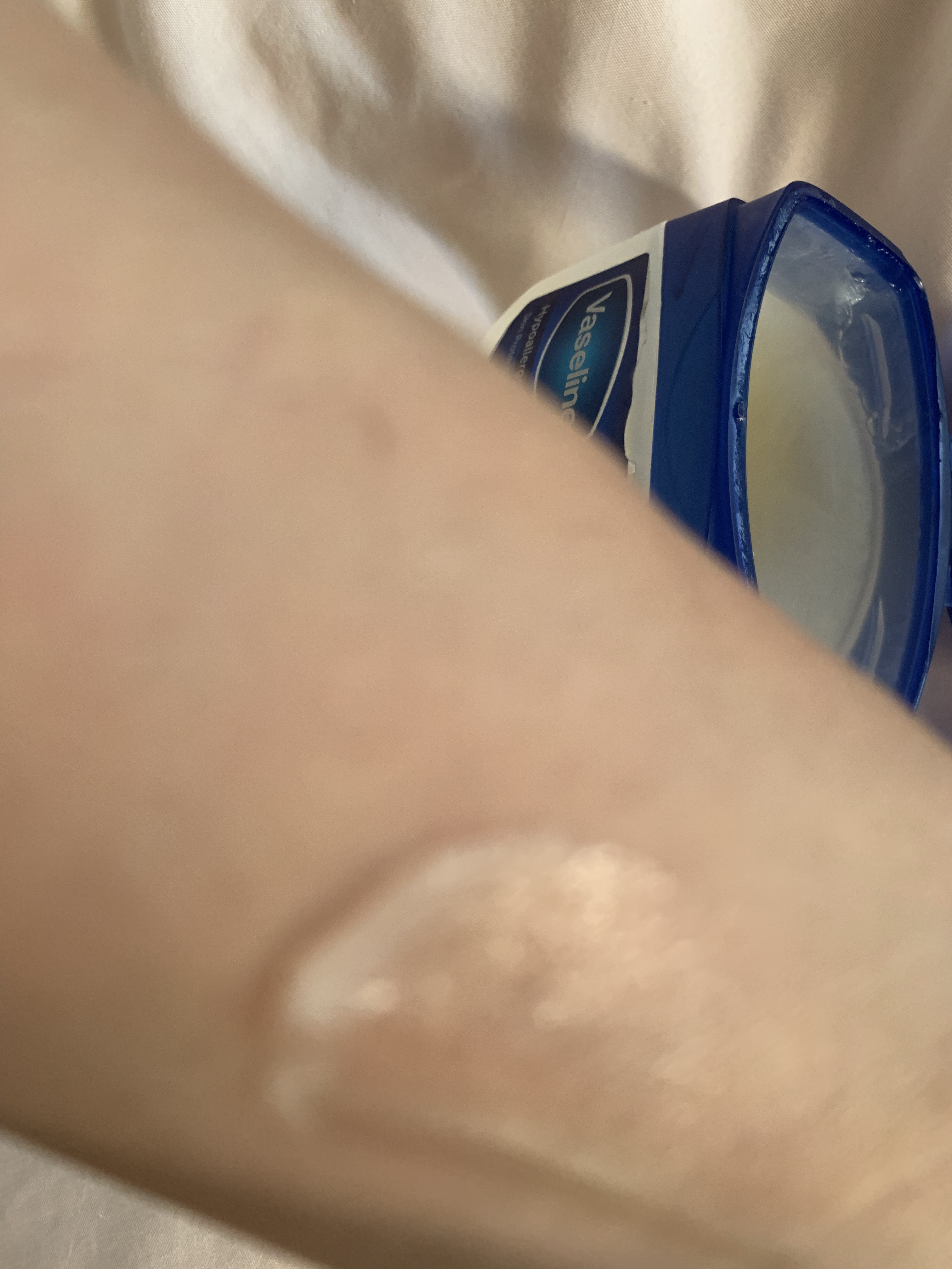 オリジナル ピュアスキンジェリー 200g/ヴァセリン/ボディクリームを使ったクチコミ（2枚目）