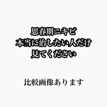 こんにちは！！！

お久しぶりです！！

顔面詐欺師です☺️

投稿頻度がかなり減ったいまでもエチュードのリップ、他にもたくさん♥来ていて通知がとても嬉しいです！！

フォロワーさんももうすぐ2000人