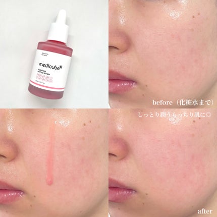PDRNピンクアンプル PDRN 10,000ppm配合/MEDICUBE/美容液を使ったクチコミ(4枚目)