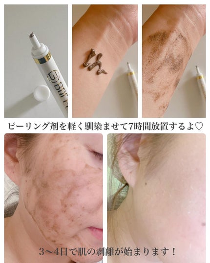 ダーマスキンピーリング/BQCELL/その他キットセットを使ったクチコミ(3枚目)