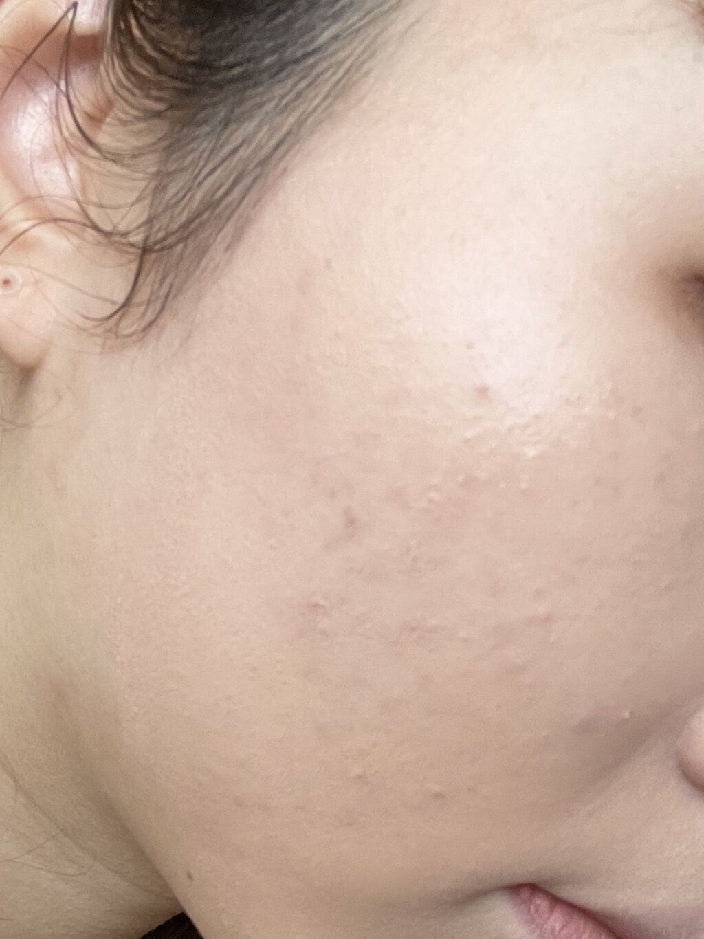 ダブル セラム バーム ファンデーション/Dr.Althea/クリーム・エマルジョンファンデーションを使ったクチコミ（3枚目）