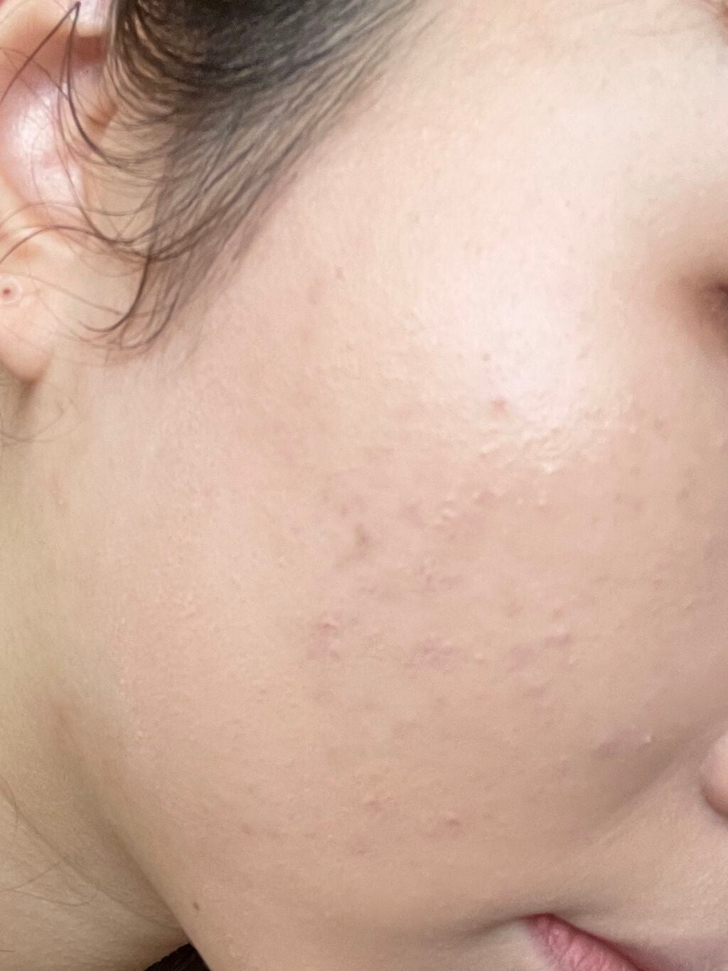 ダブル セラム バーム ファンデーション/Dr.Althea/クリーム・エマルジョンファンデーションを使ったクチコミ(3枚目)