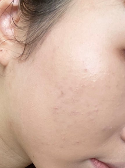 ダブル セラム バーム ファンデーション/Dr.Althea/クリーム・エマルジョンファンデーションを使ったクチコミ(3枚目)