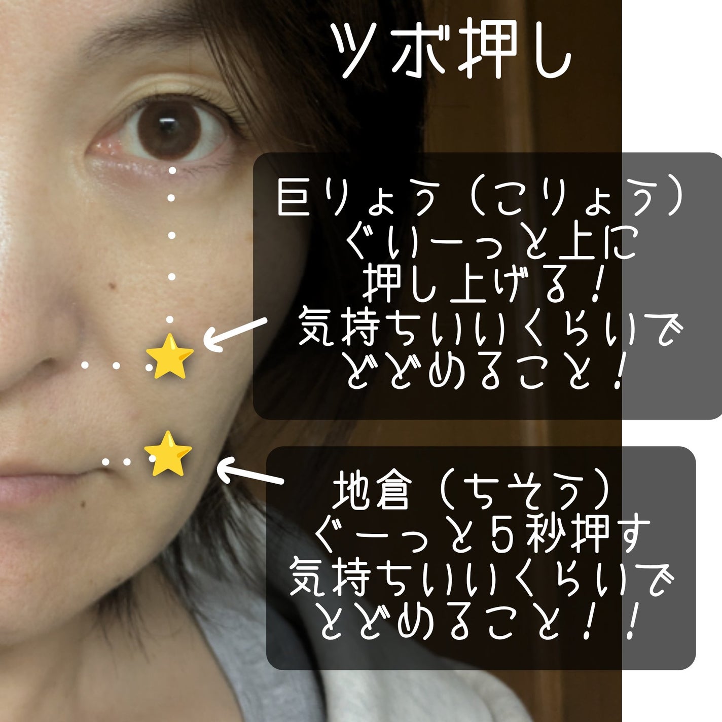 プロバイオダーム リフティング クリーム/BIOHEAL BOH/フェイスクリームを使ったクチコミ(1枚目)