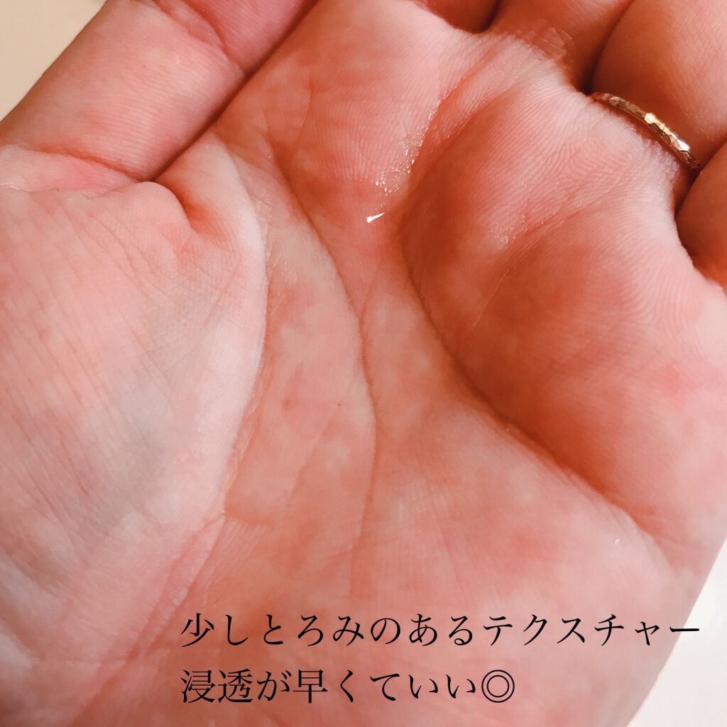 オバジX リフトローション/オバジ/化粧水を使ったクチコミ(2枚目)