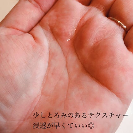 オバジX リフトローション/オバジ/化粧水を使ったクチコミ(2枚目)