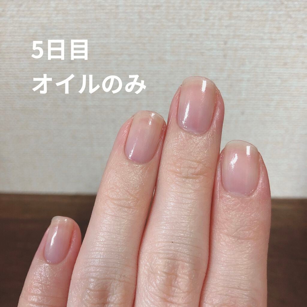 ネイルエンビー/O・P・I/ネイルオイル・トリートメントを使ったクチコミ(7枚目)
