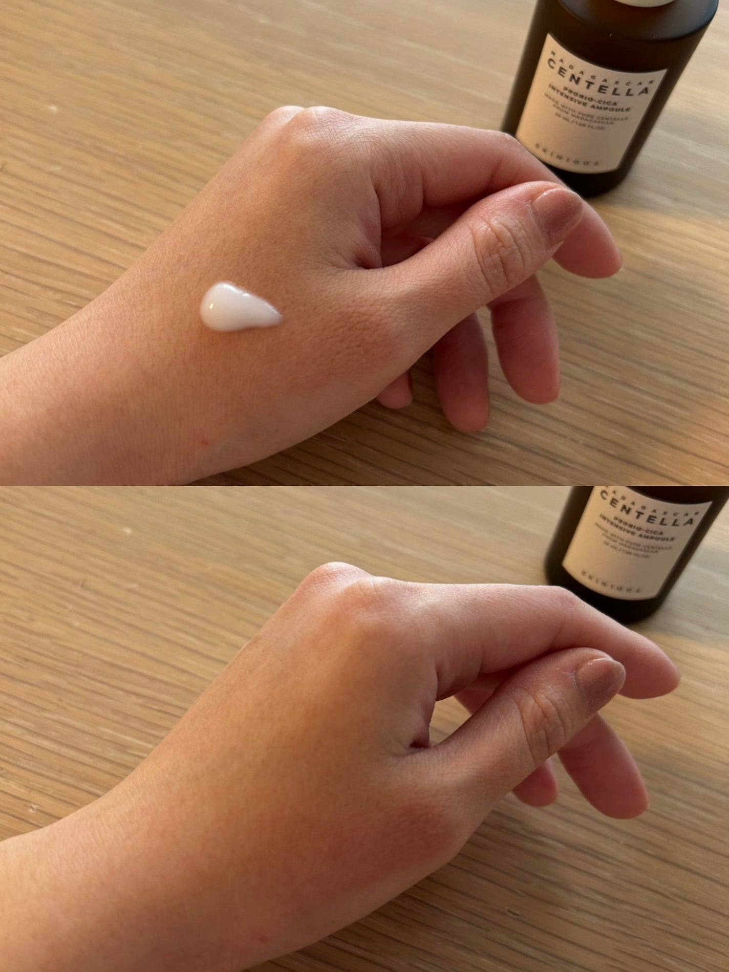 プロバイオシカ インテンシブ アンプル/SKIN1004/美容液を使ったクチコミ(3枚目)