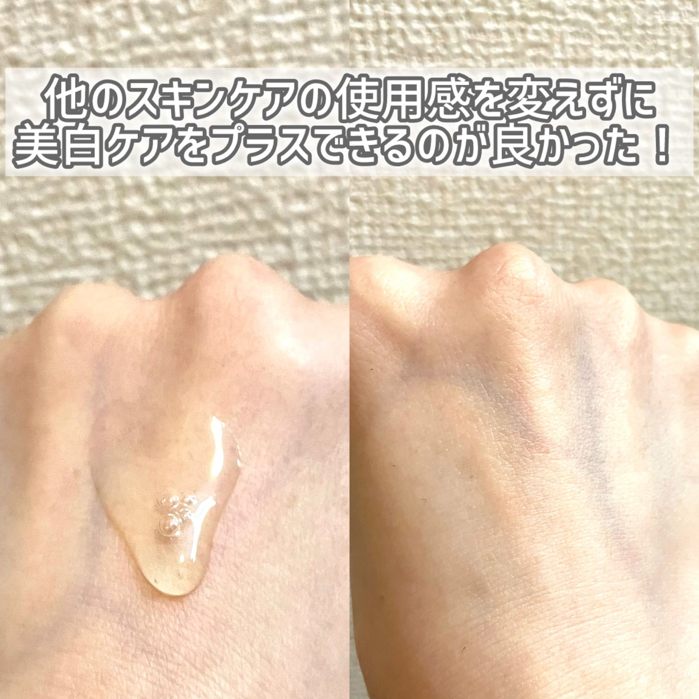 ナイアシンアミドブレミッシュケアセラム/ONE THING/美容液を使ったクチコミ(4枚目)