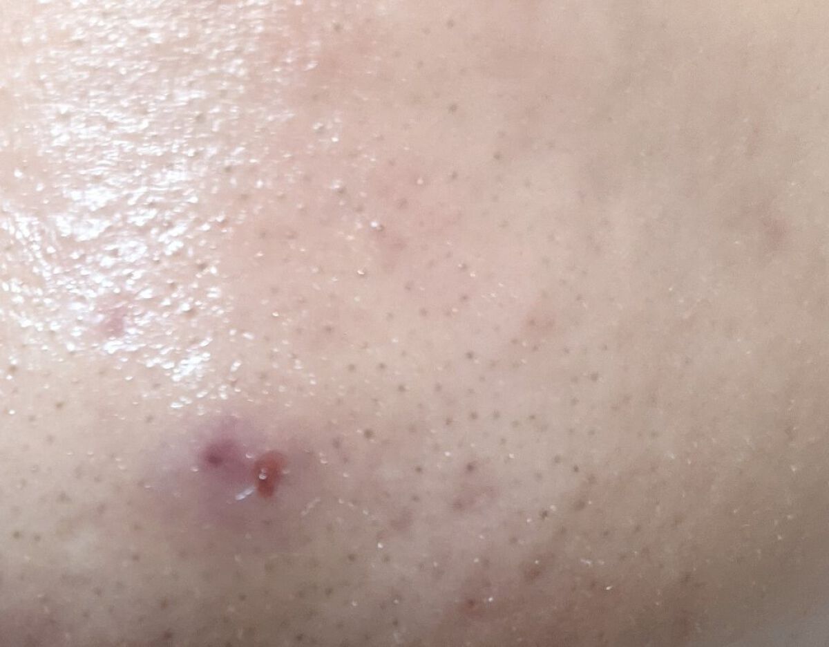 浸透湿潤セラミド１０％★ナノエマルジョン/TOUT VERT/乳液を使ったクチコミ（3枚目）