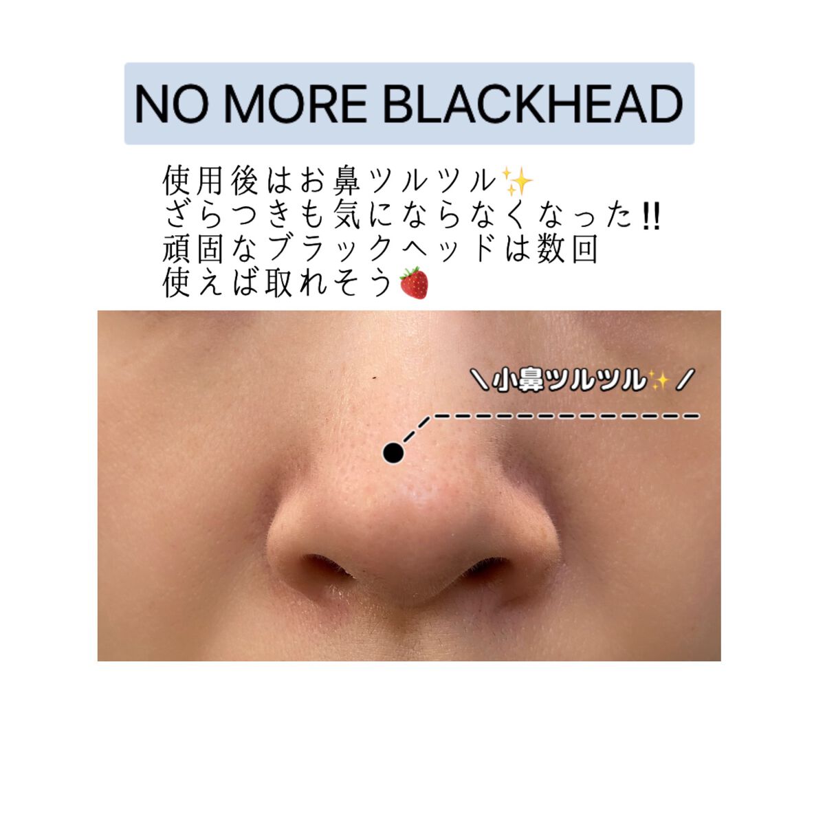 ノーモアブラックヘッド(ノーズピーリング)/One-day's you/スクラブ・ゴマージュを使ったクチコミ(4枚目)