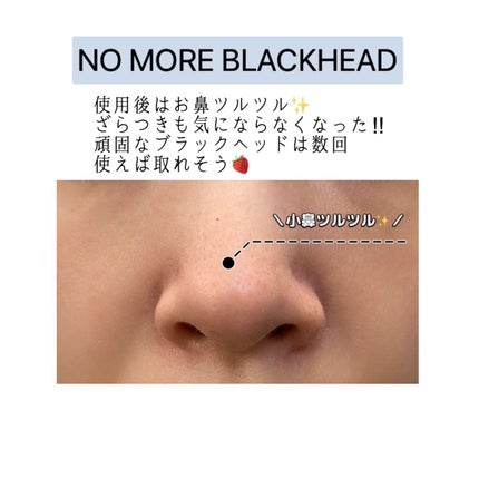ノーモアブラックヘッド(ノーズピーリング)/One-day's you/スクラブ・ゴマージュを使ったクチコミ(4枚目)