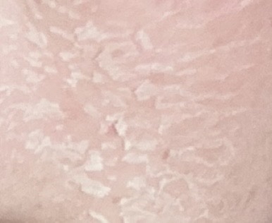 ミラミックス/ZO Skin Health/フェイスクリームを使ったクチコミ（3枚目）