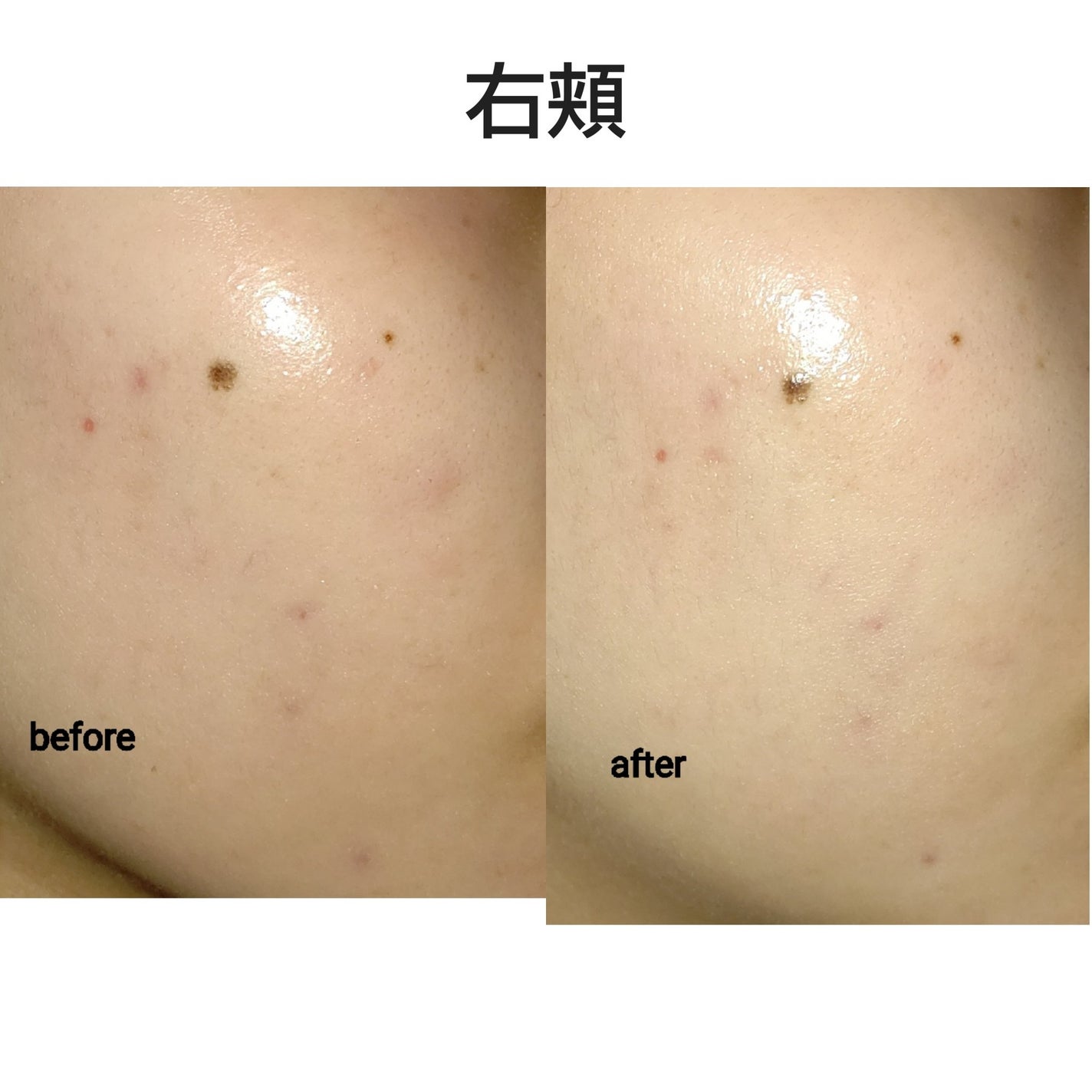 レチノール0.3 ナイアシンリニューイングセラム/Anua/美容液を使ったクチコミ(2枚目)