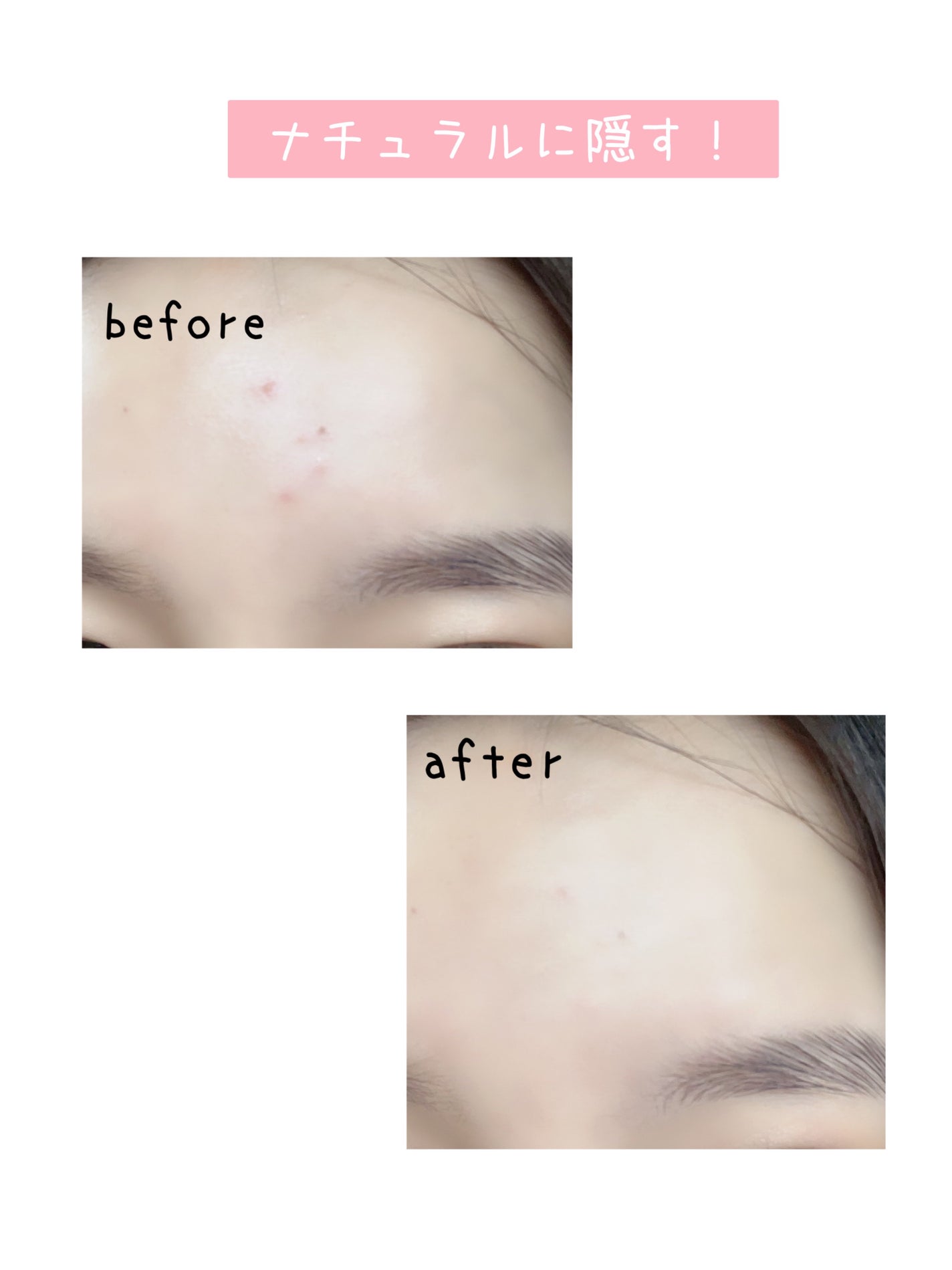 カラーミキシングコンシーラー/キャンメイク/パレットコンシーラーを使ったクチコミ(1枚目)