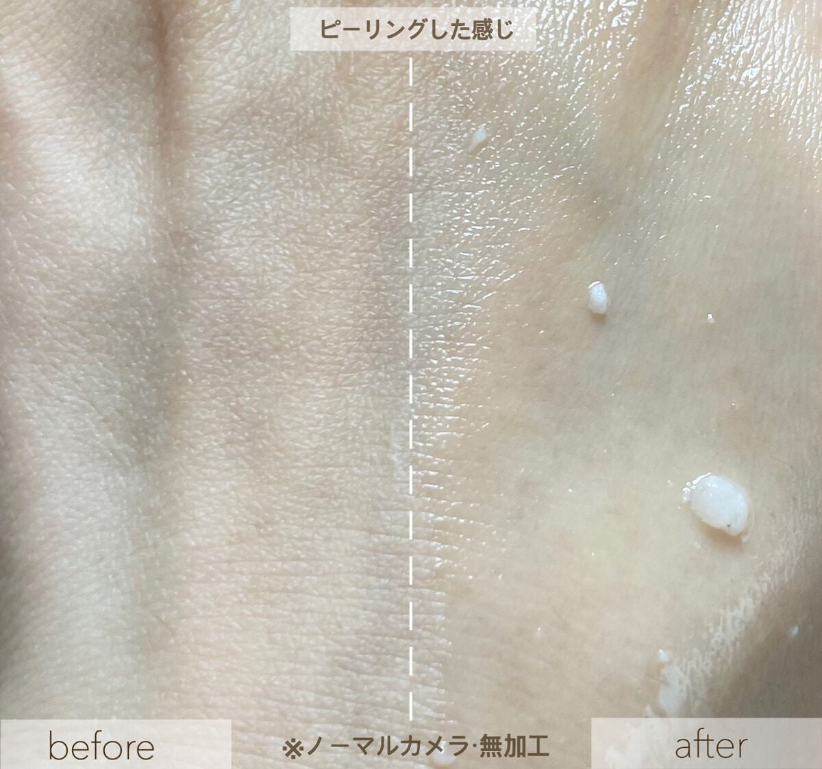 フェイシャルマイルドピーリング/primera/ピーリングを使ったクチコミ(9枚目)