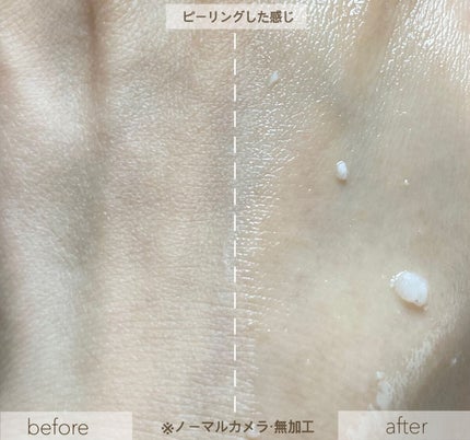 フェイシャルマイルドピーリング/primera/ピーリングを使ったクチコミ(9枚目)