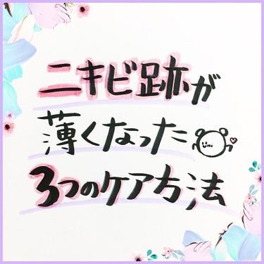 TUNEMAKERS VC-20 ビタミンC誘導体のクチコミ「ニキビ跡、薄くなった😭🤍🌸


【ニキビ跡が薄くなった
3つのケア方法】

ニキビ跡、超悩んだ.....」（1枚目）