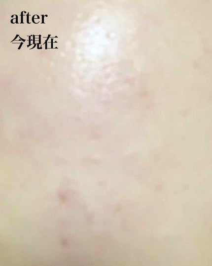 ドクタージャルト シカペア クリーム (第2世代)/Dr.Jart+/フェイスクリームを使ったクチコミ(3枚目)