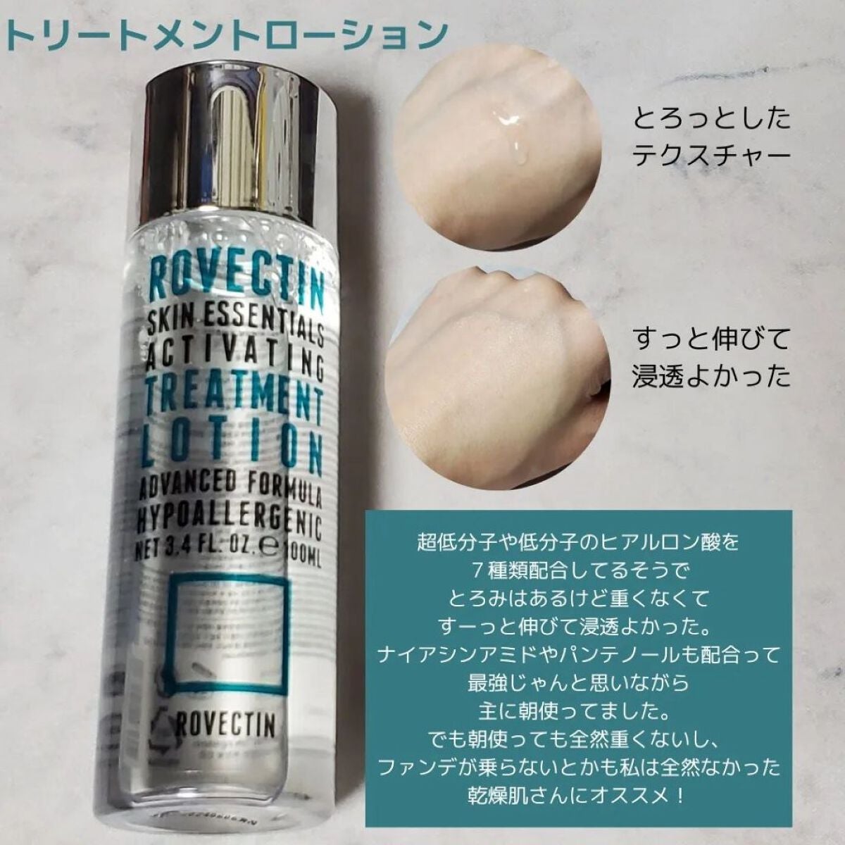 エッセンシャル トリートメントローション/ロベクチン/化粧水を使ったクチコミ(2枚目)