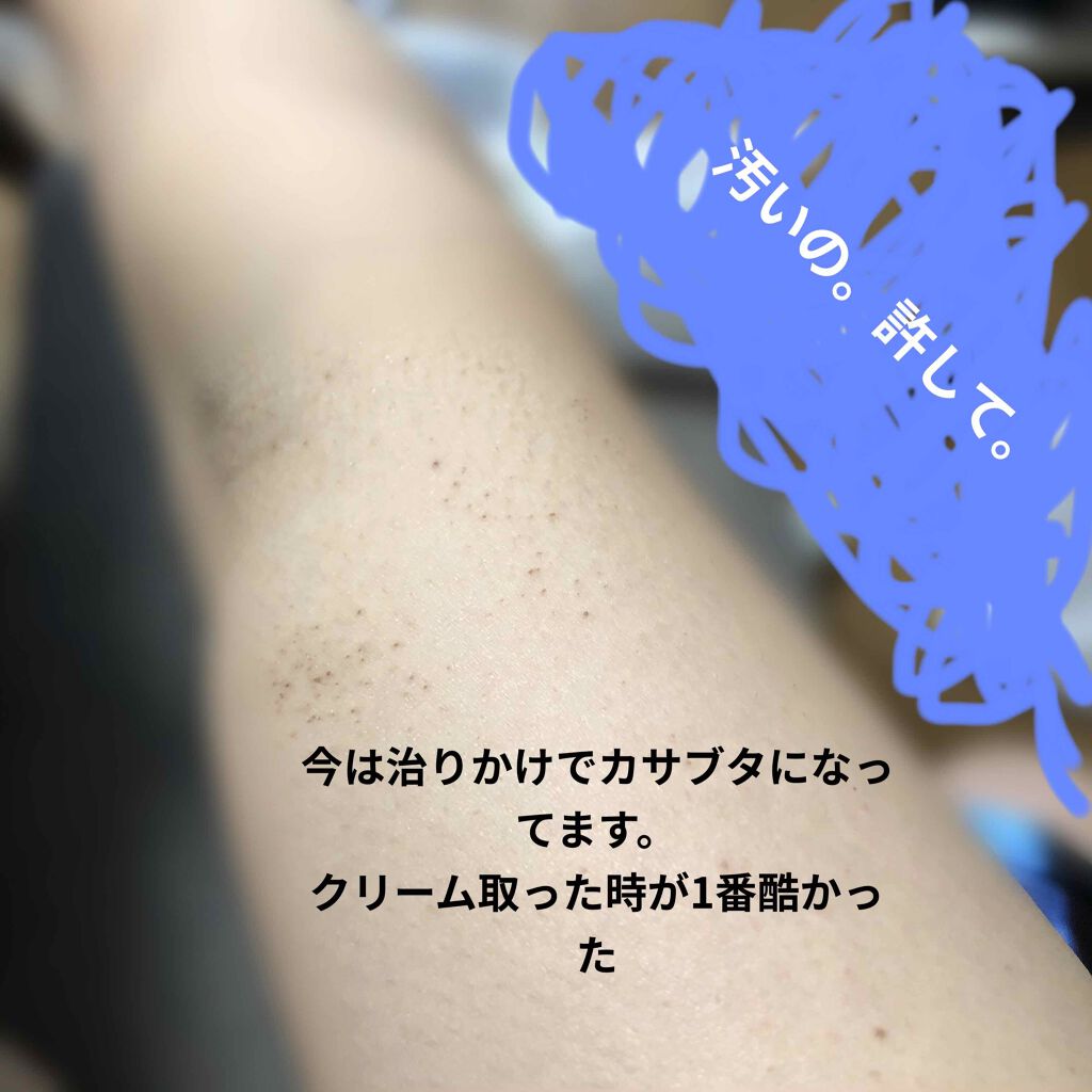 バスタイム除毛クリーム 敏感肌用/Veet/除毛クリームを使ったクチコミ(2枚目)