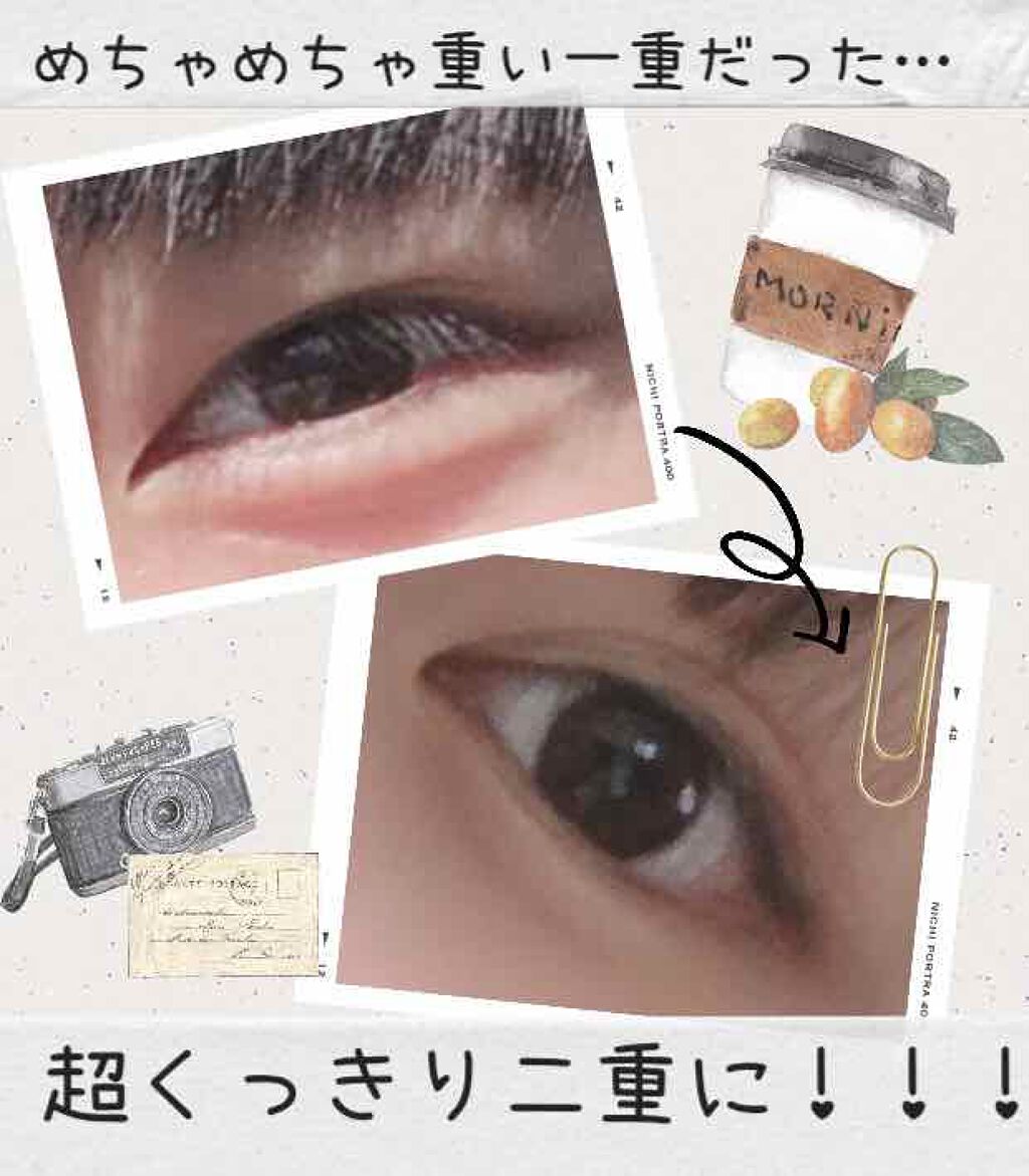 二重まぶた用シール/DAISO/二重まぶた用アイテムを使ったクチコミ(1枚目)