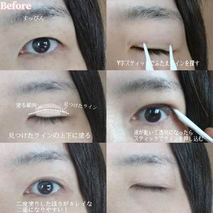 タフグルーX/フィクシー/二重まぶた用アイテムを使ったクチコミ(5枚目)