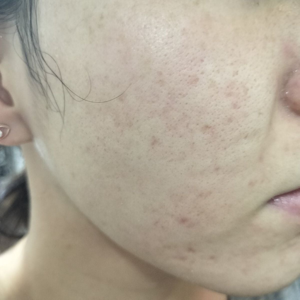 miina@汚肌工事録⚠️ on LIPS 「10/16の#汚肌工事録ありがとう🐰🐰/写真下手だけど疲れを何..」(1枚目)