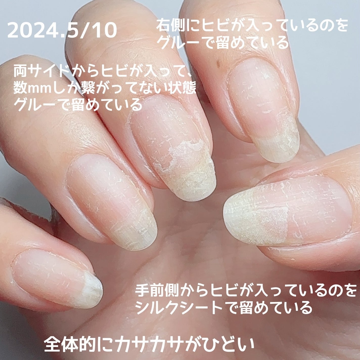 スーパーベース/SHINYGEL/ジェルネイルを使ったクチコミ(4枚目)