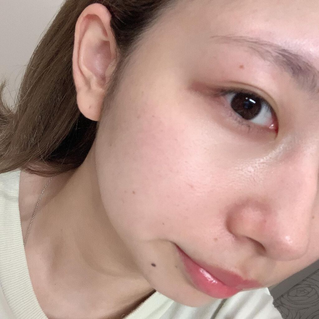 yukka on LIPS 「【APLIN】"ピンクティーツリートナー"使ってみた🌸Qoo1..」(3枚目)