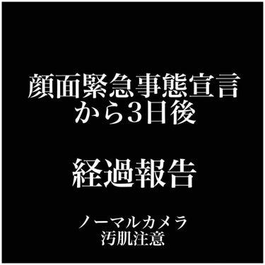 ナチュリエ ハトムギ化粧水(ナチュリエ スキンコンディショナー R )のクチコミ「前回のニキビ大量発生からの経過です。

結果よくなったと思います。。。

使ったもの
.....」（1枚目）