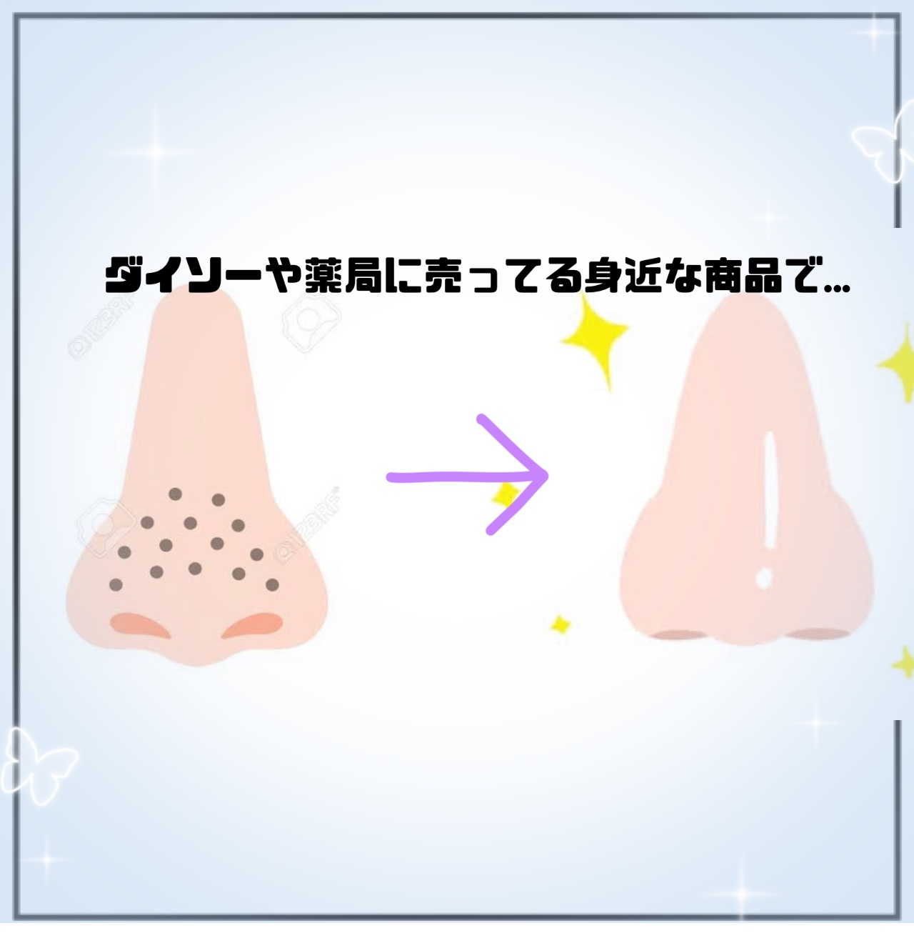 ジョンソンベビーオイル微香性/ジョンソンベビー/ボディオイルを使ったクチコミ（1枚目）