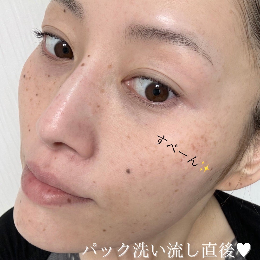 ゼロ毛穴パッド 2.0/MEDICUBE/トナーパッドを使ったクチコミ(7枚目)