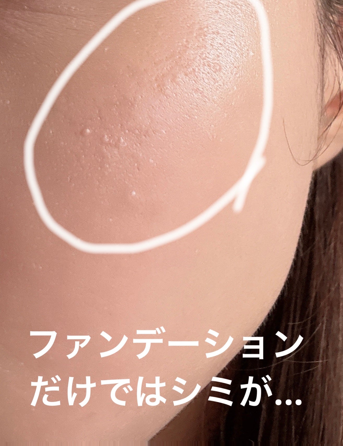 ドラマティックコンシーラー/マキアージュ/クリームコンシーラーを使ったクチコミ(2枚目)