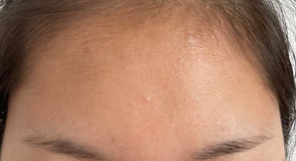 オードムーゲ 薬用ローション(ふきとり化粧水)/オードムーゲ/拭き取り化粧水を使ったクチコミ(2枚目)