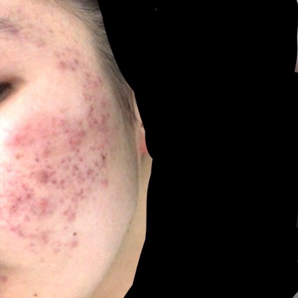 デュオ ザ クレンジングバーム/DUO/クレンジングバームを使ったクチコミ(3枚目)