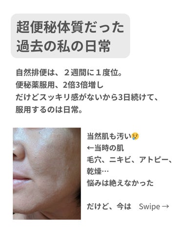 美肌カウンセラー💆綺麗のお助け相談所 on LIPS 「便秘の人、これ絶対に試してほしい💩もう便秘で悩むのはおしまい！..」（4枚目）