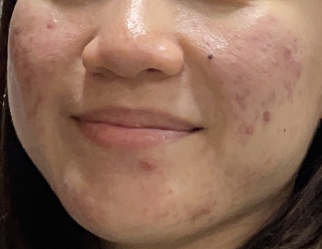 敏感肌用乳液　高保湿/無印良品/乳液を使ったクチコミ（2枚目）