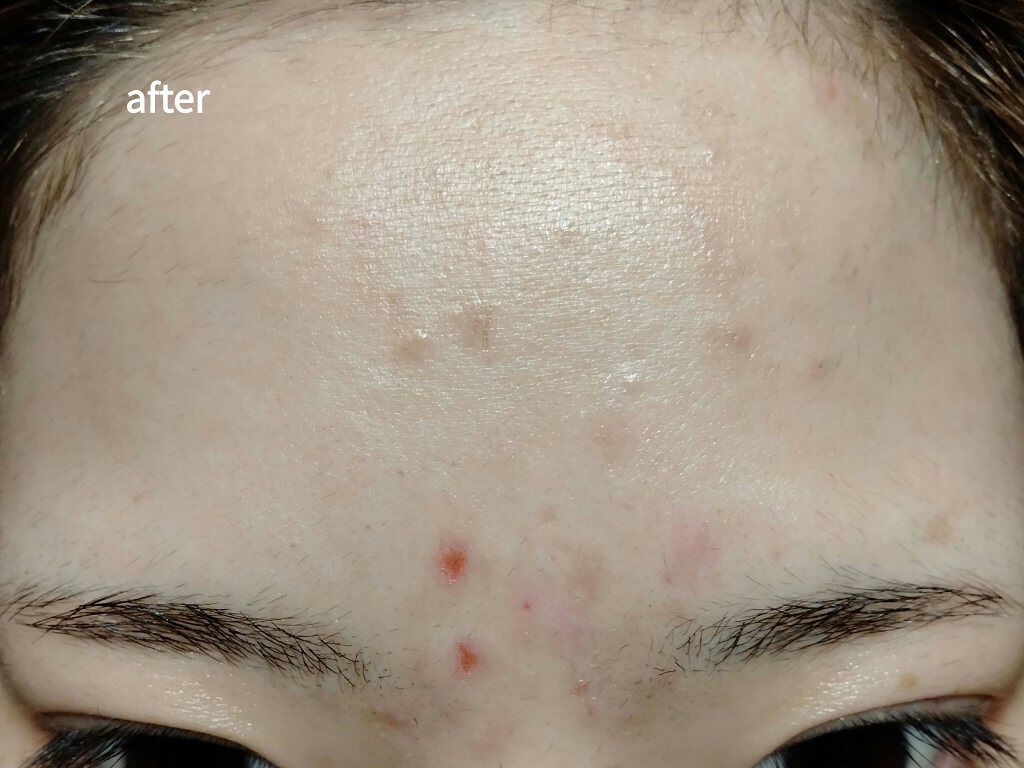 を使ったクチコミ（1枚目）