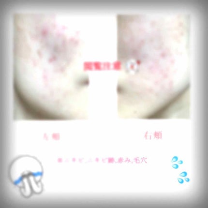 敏感肌用薬用美白美容液/無印良品/美容液を使ったクチコミ(1枚目)