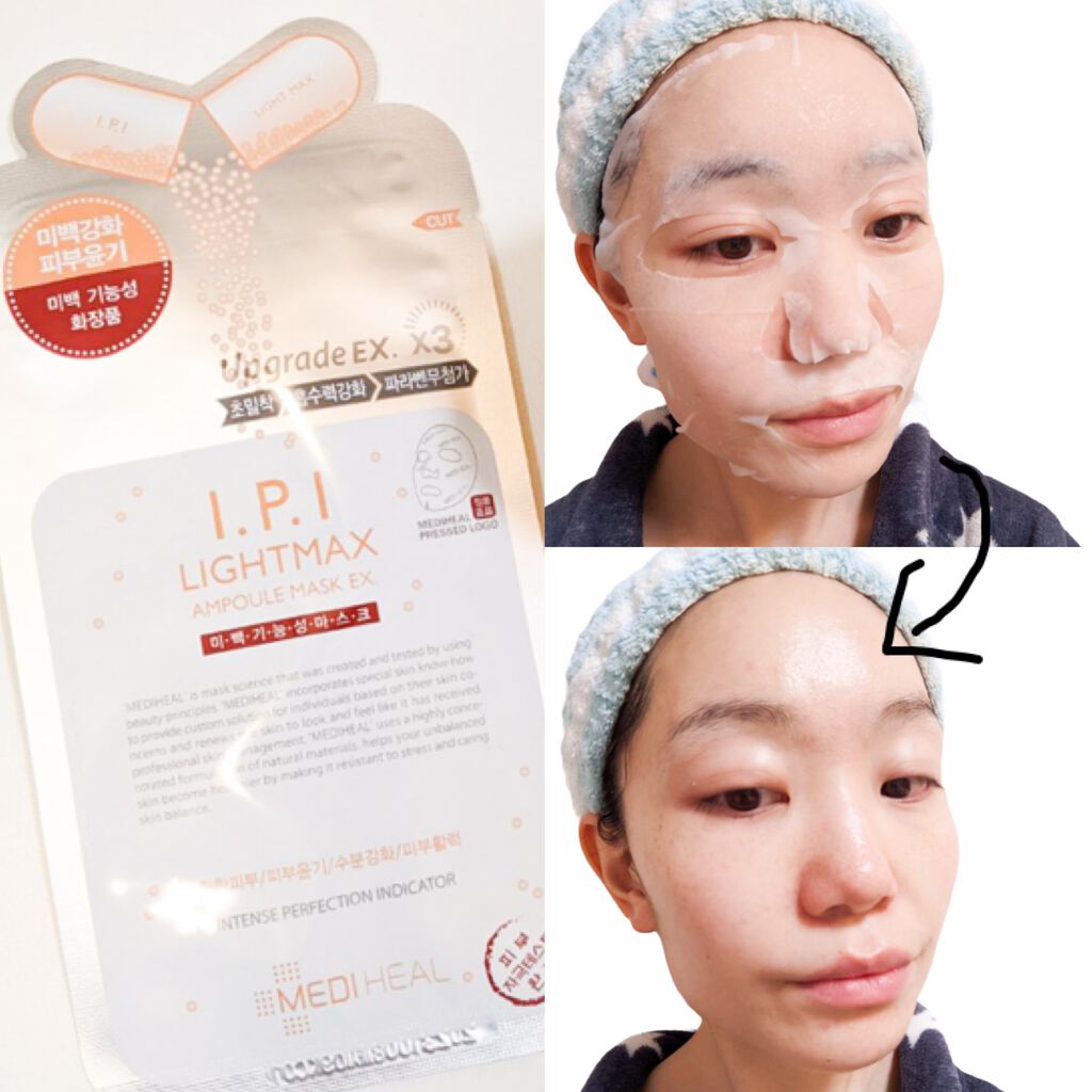 I.P.IライトマックスAPマスクEX/MEDIHEAL/シートマスク・パックを使ったクチコミ（2枚目）