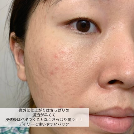 黒真珠マスク/我的美麗日記/シートマスク・パックを使ったクチコミ(6枚目)