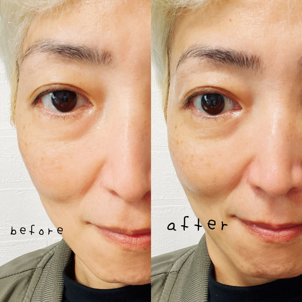 REプラセンタ美容液/RE(アール・イー)/美容液を使ったクチコミ（2枚目）