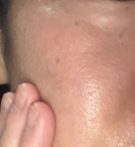 タカミスキンピール/タカミ/ブースター・導入液を使ったクチコミ(5枚目)