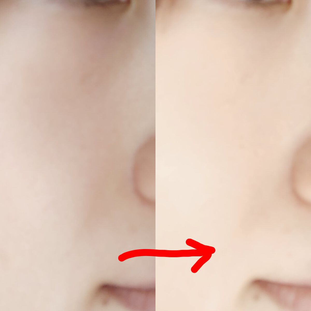 アディクション スキンリフレクト フィックス コンシーラー 005 Light-Med Beige/ADDICTION/リキッドコンシーラーを使ったクチコミ（3枚目）