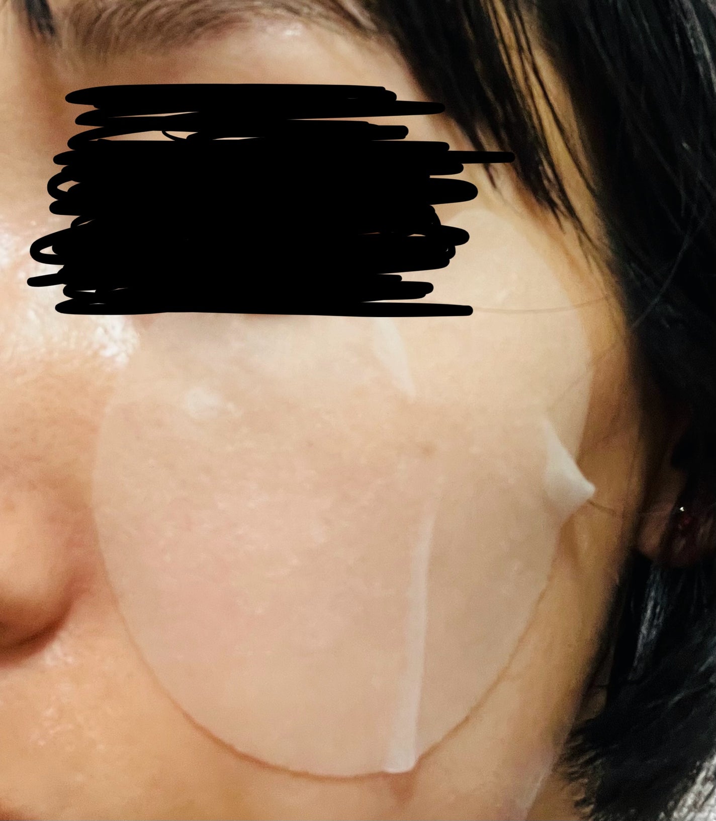 センテラ クイックカーミングパッド/SKIN1004/トナーパッドを使ったクチコミ(3枚目)