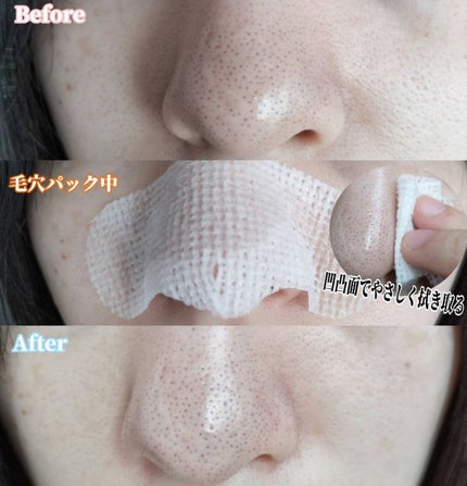 ノーモアブラックヘッド ポアジェルクリーム/One-day's you/フェイスクリームを使ったクチコミ(3枚目)