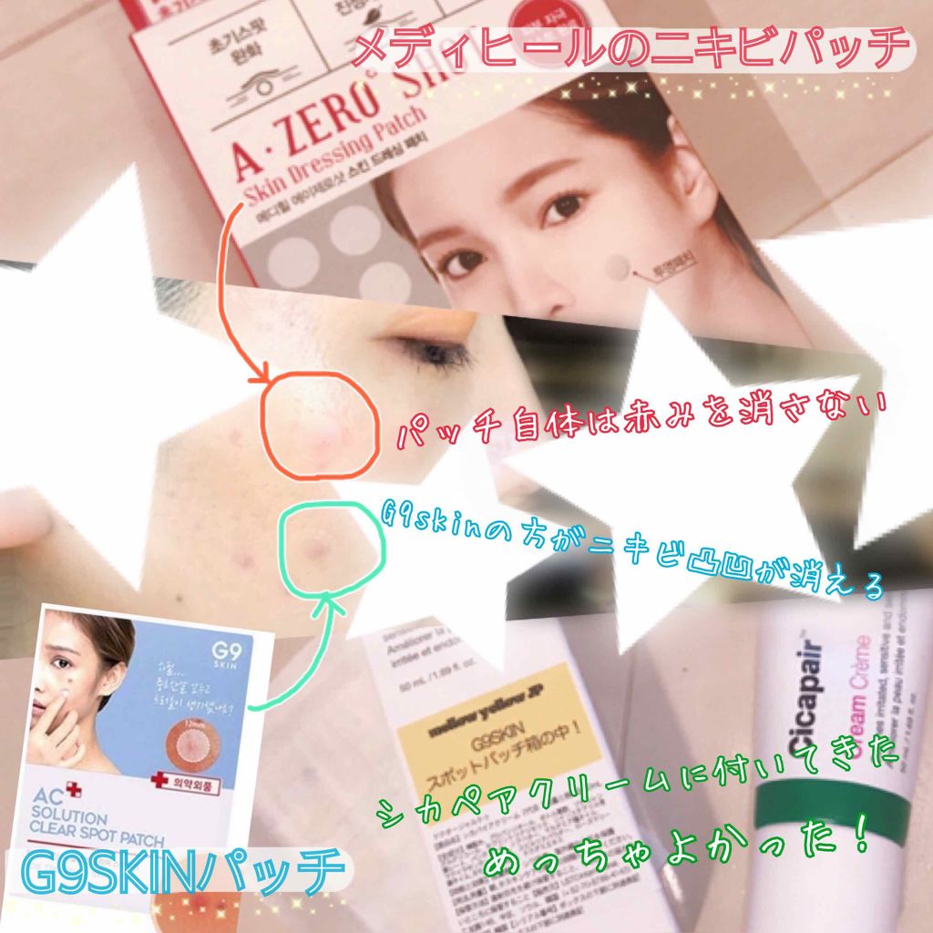 Nexcare/3M nexcare/にきびパッチを使ったクチコミ（3枚目）