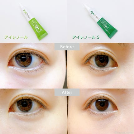 アイレノール クマクリーム/IRENOL/アイケア・アイクリームを使ったクチコミ(4枚目)