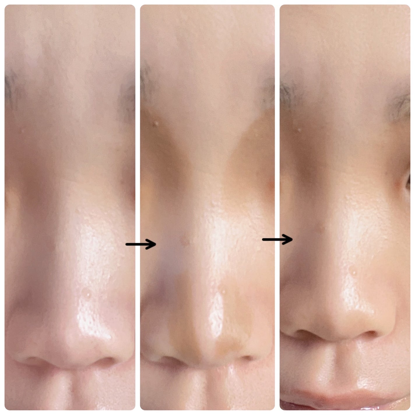 シェイプマジックスティック/MilleFée/シェーディングを使ったクチコミ(5枚目)